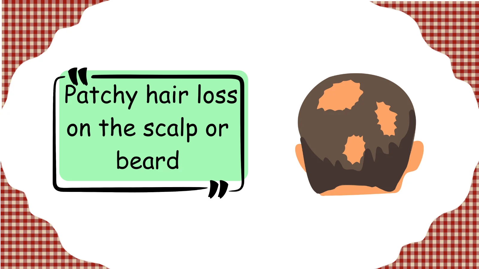 Discover Alopecia Meaning and Surprising Facts You Need